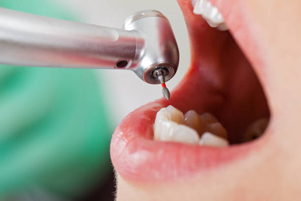 Best Cracked Tooth Emergency Dentist  in Ashford, AL